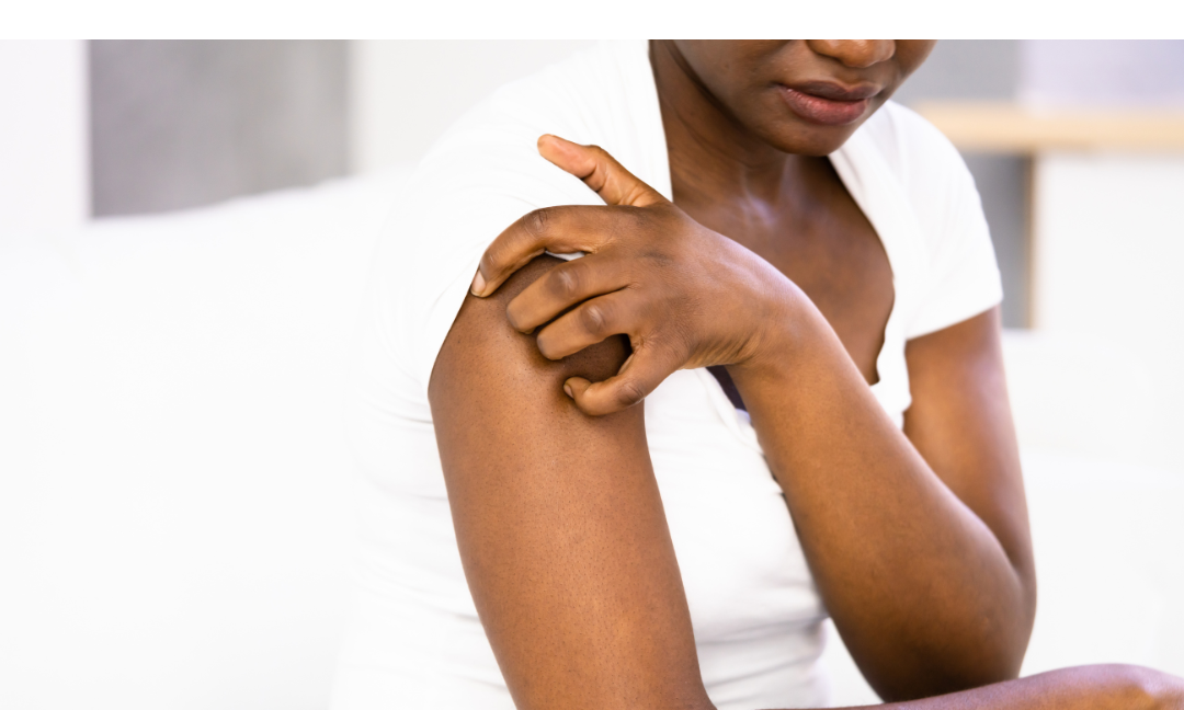The Top Eczema Triggers (And How to Avoid Them)